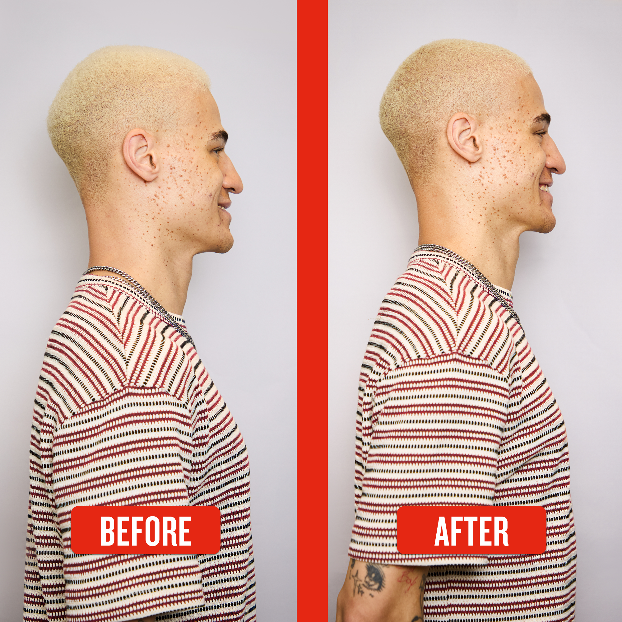 Before and after comparison of a person with a striped shirt on a plain background