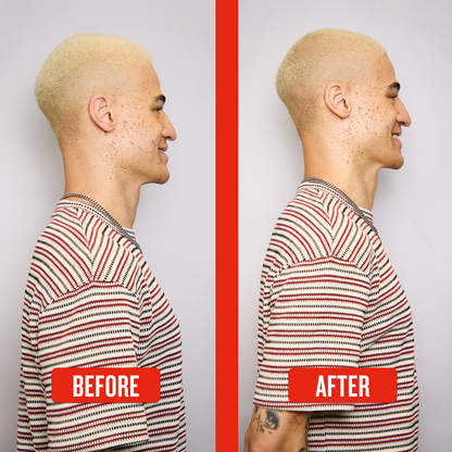 Before and after comparison of a person with a striped shirt on a plain background